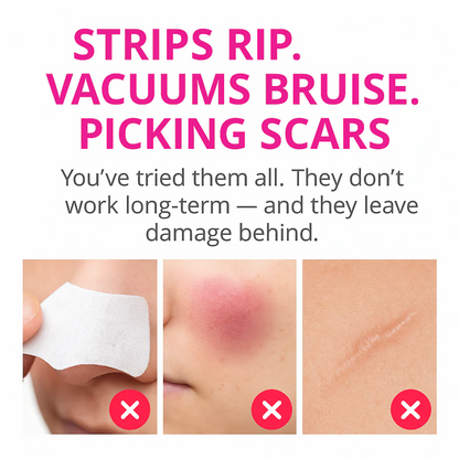 EverSmooth PoreLift™